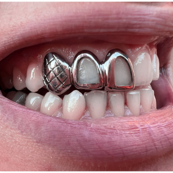 Windows & Diamond Cut Grillz