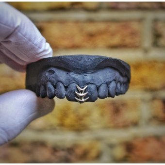 Gapfiller Chevron Grillz