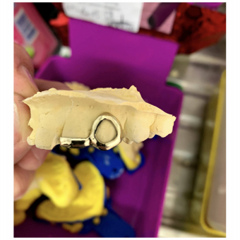 Window and Bar Grillz