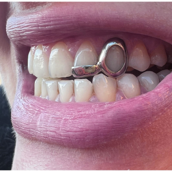 Window and Bar Grillz