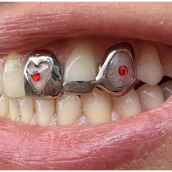 Acryl and Pearl Grillz