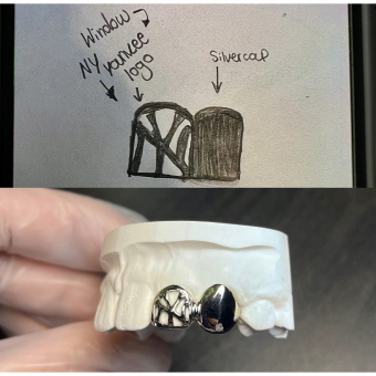 Custom Design Grillz