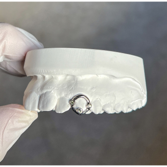 3 Stone Window Grillz