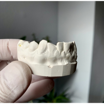 Tooth Filler 2 pieces Grillz