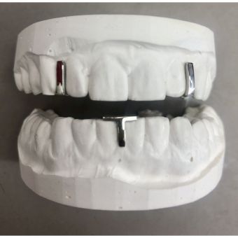 Gapfiller Beeline Grillz