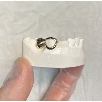 Tooth Filler 2 pieces Grillz