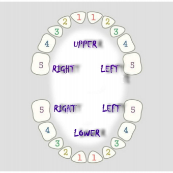 Design Window and Bar Grillz