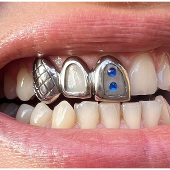 Acryl and Pearl Grillz
