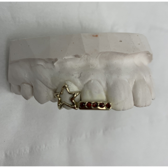 Diamonds And Star grillz