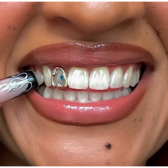 3 Stone Window Grillz