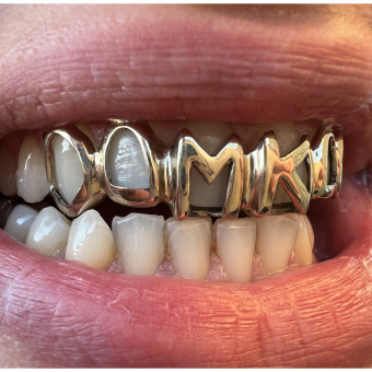 Unique Set Grillz