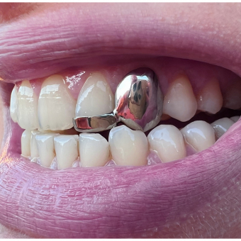 Solid Cap & Bar Grillz