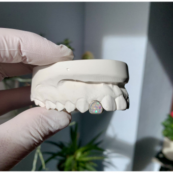 Opal Window Single Grillz