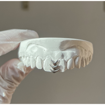 Gapfiller Chevron Grillz