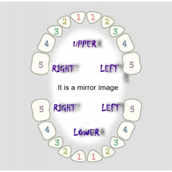 Solid Cap & Bar Grillz