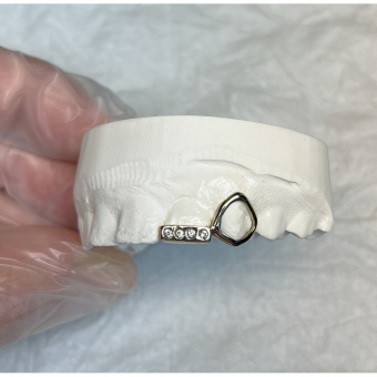 Window and Bar VVS Grillz