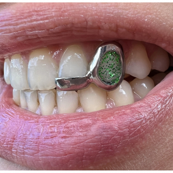 Window and Bar Grillz with Acryl