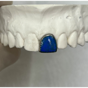 Fired Ceramic Custom Grillz