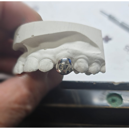 Engraved Grillz