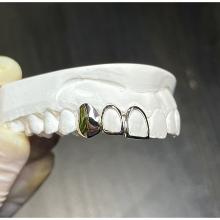 Triple Caps Grillz